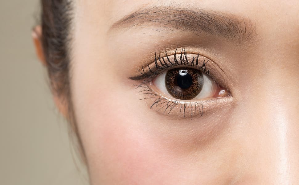 eyebag laser treatment